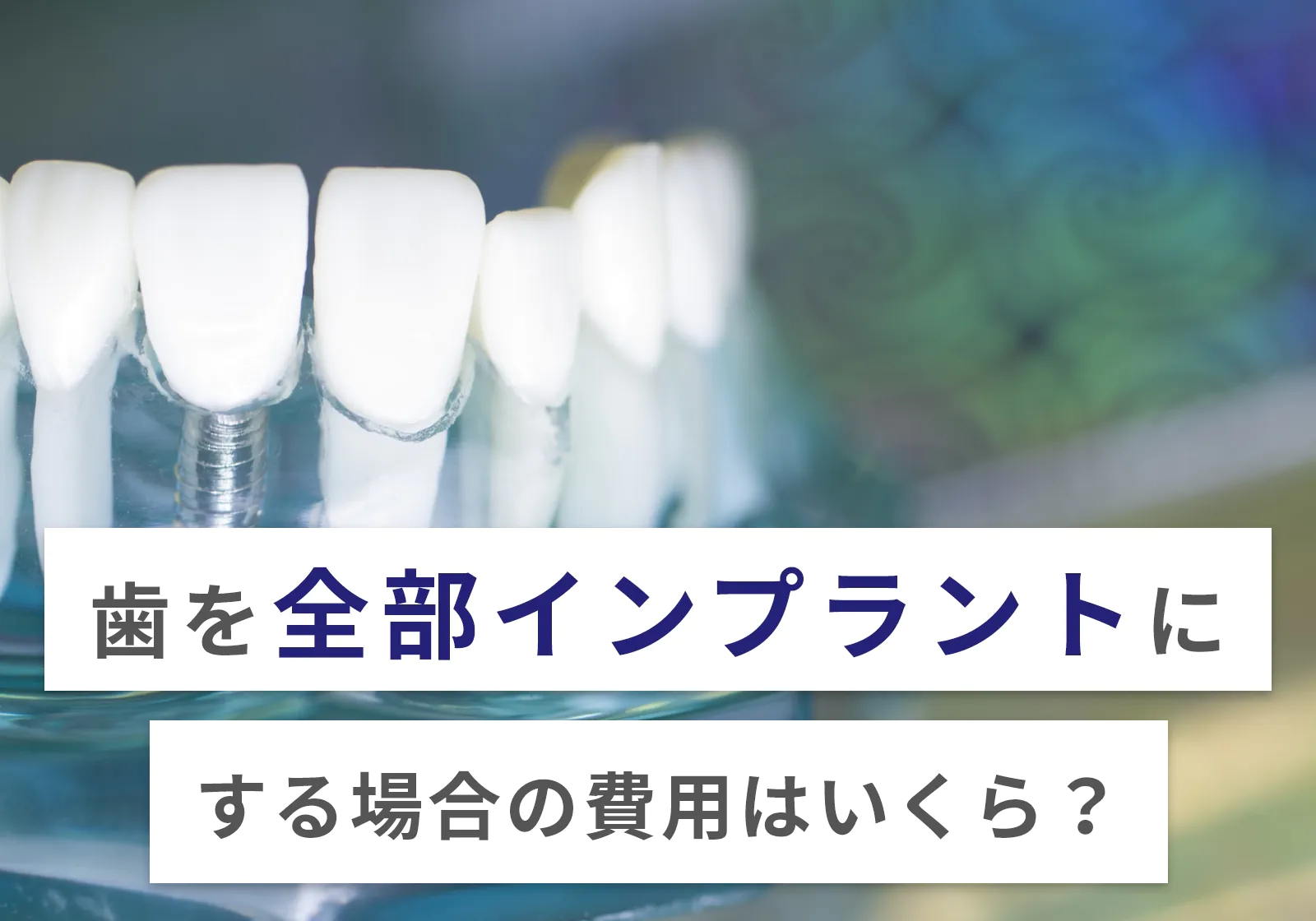 歯を全部インプラント(オールオン4)にする際の費用は480〜960万円！デメリットも本音で解説